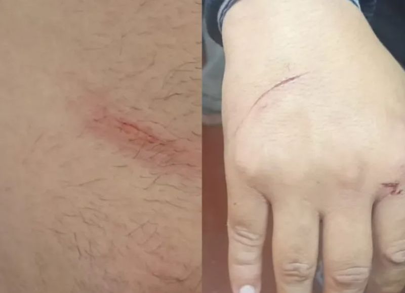 Detuvieron a un hombre que lo buscaban por robo en Resistencia, intentó huir y apuñaló a dos policías